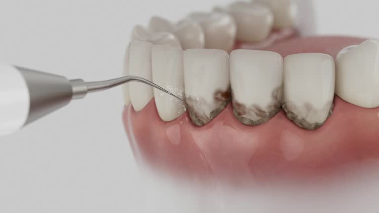 Reliable Dental contractor in Glendale, AZ by Smile Center Dentistry